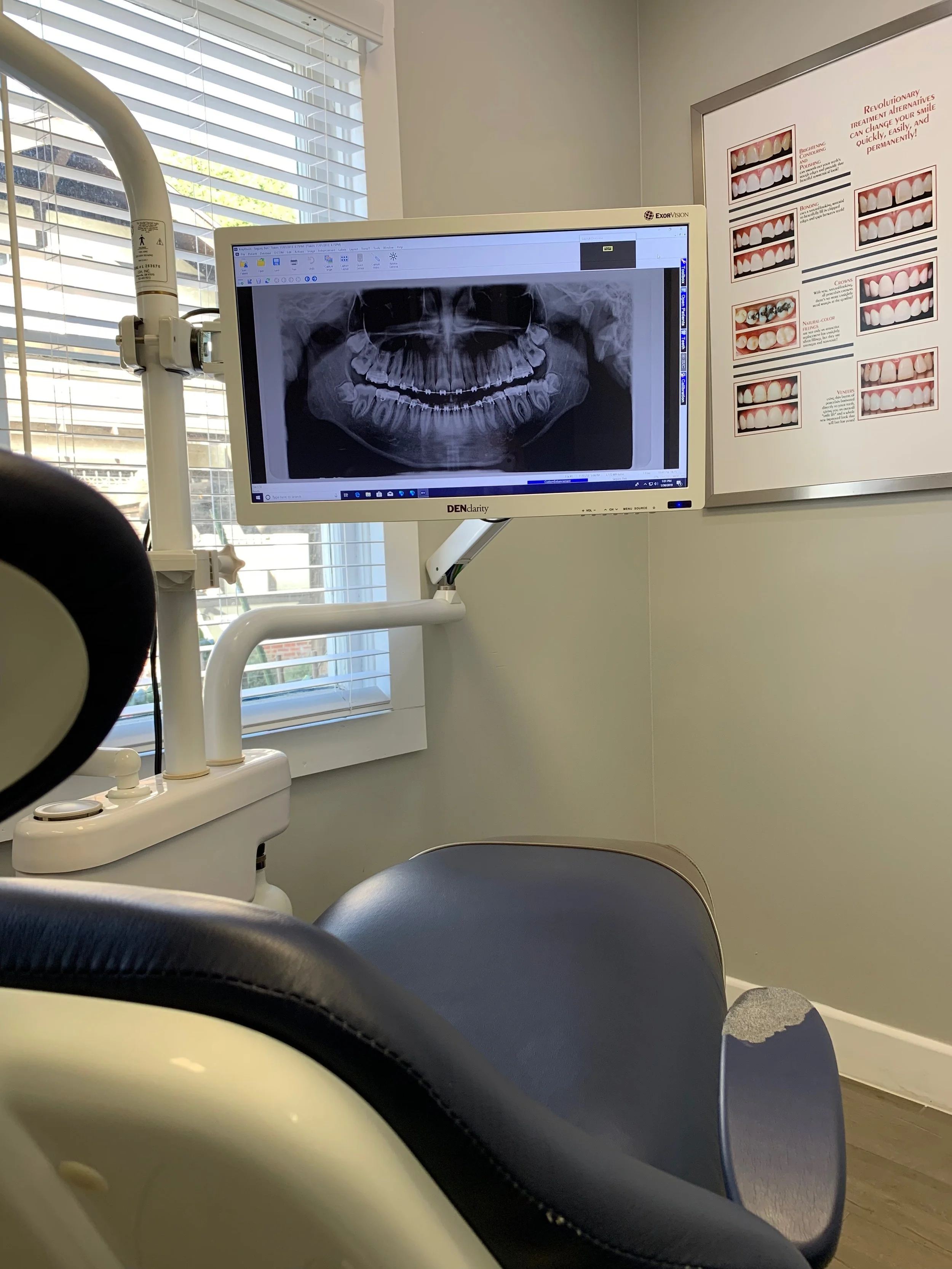 upland dental digital x-rays.JPG