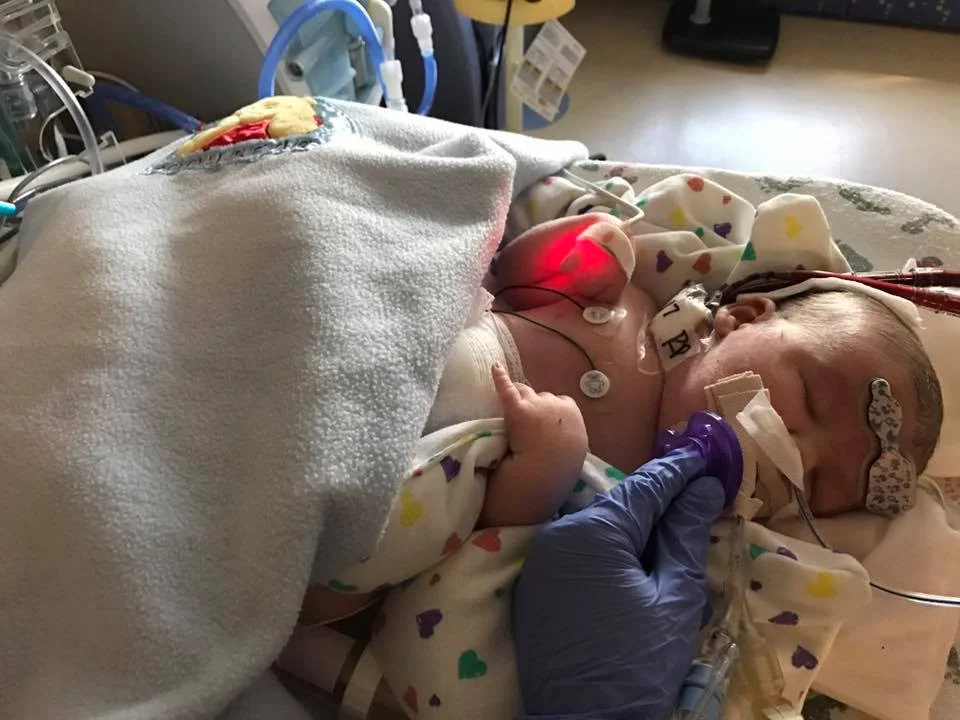 zachary on ecmo.jpg