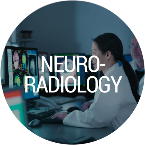 neuroradiology specialty at bay imaging consultants