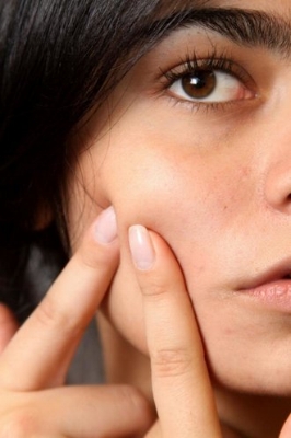 Botox: The New Way To Combat Acne