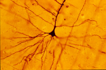 Golgi stain of human pyramidal neuron