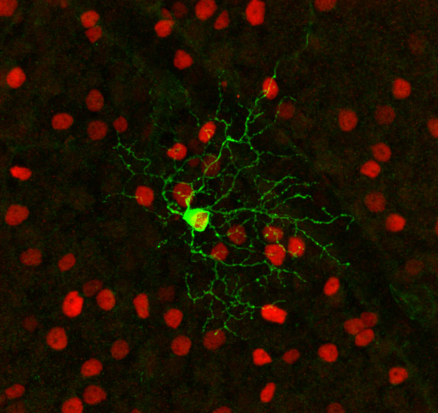 rgc-single-cell-plus-many.jpg