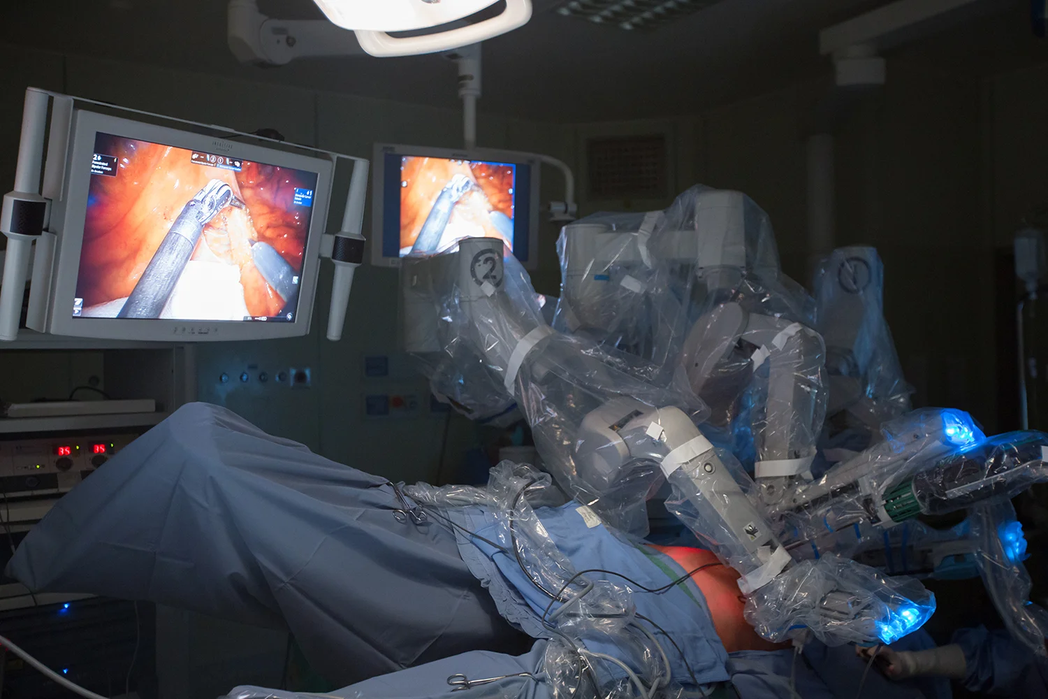  Da Vinci Robot, Forlì, Italy 