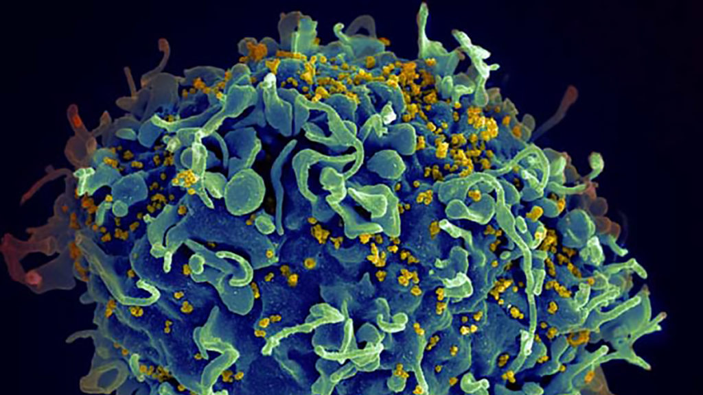 Source: National Institutes of Health