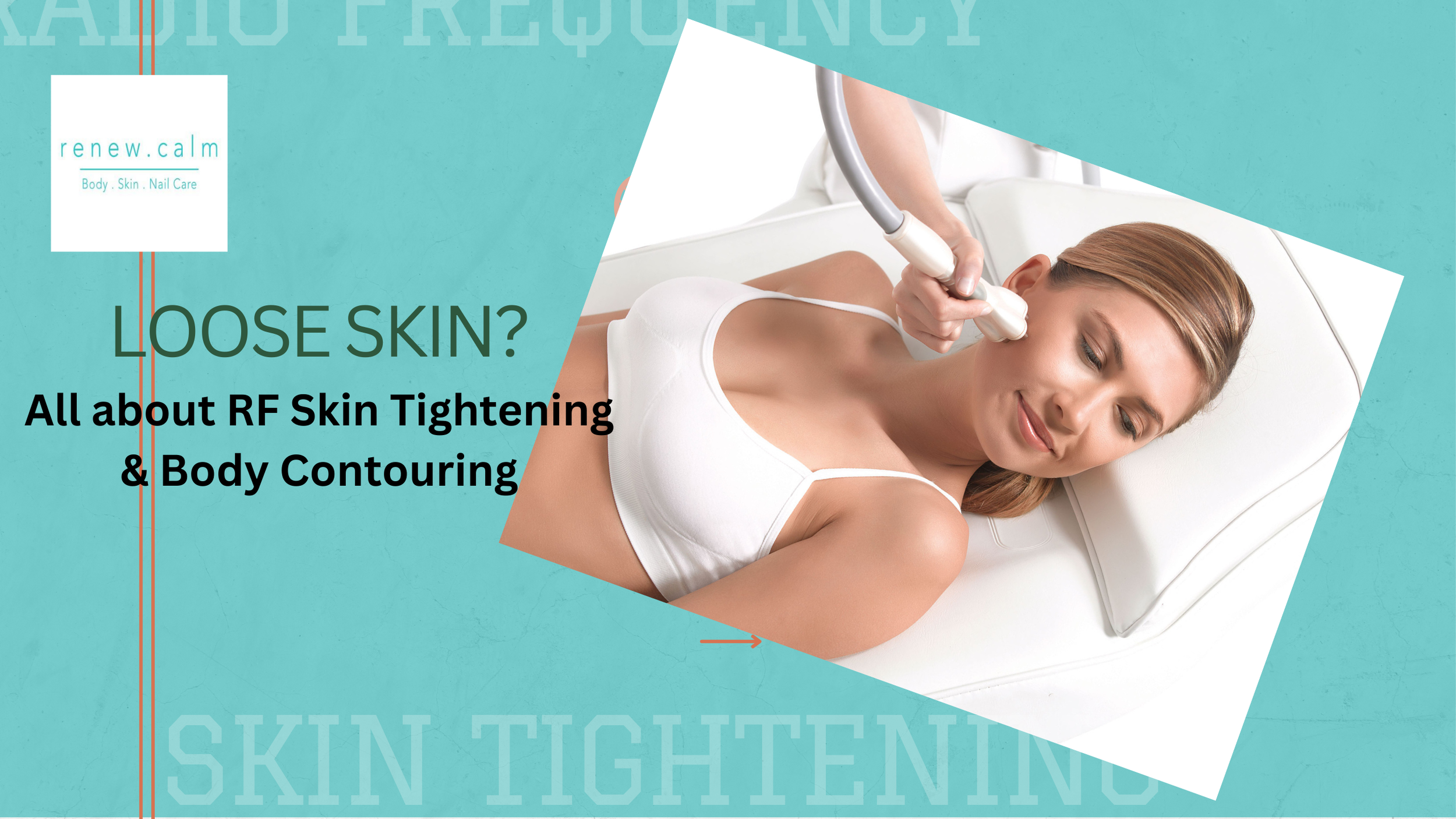 Radio Frequency (RF) Skin Tightening and Body Contouring