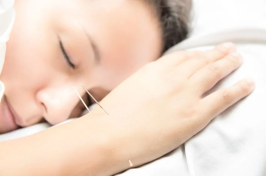 acupuncture.jpg