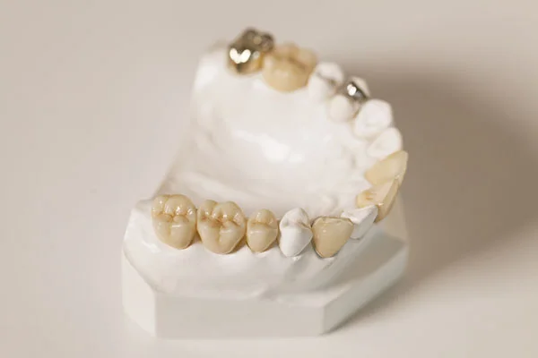crown examples.jpg
