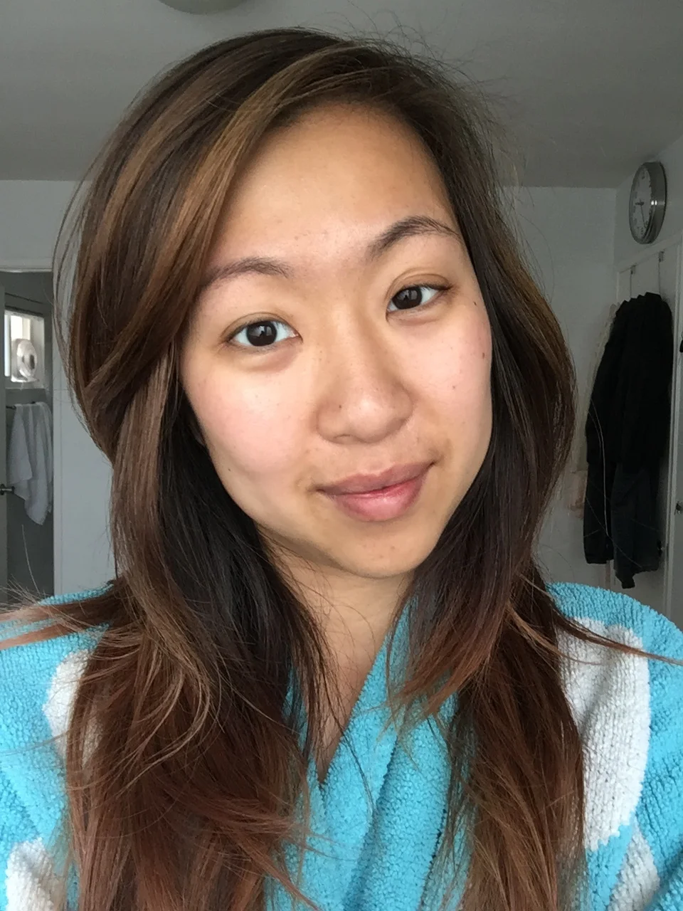 After 3 weeks (un-retouched): my cheeks aren't as red, my forehead isn't as pigmented and my chin isn't as dark. 