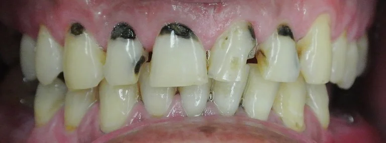 no2-before.jpg
