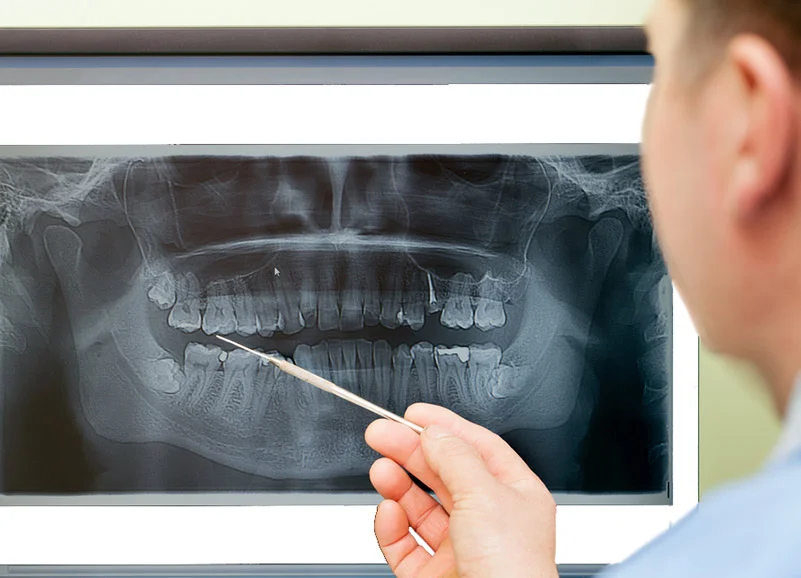 Dental-Digital-XRay2.jpg