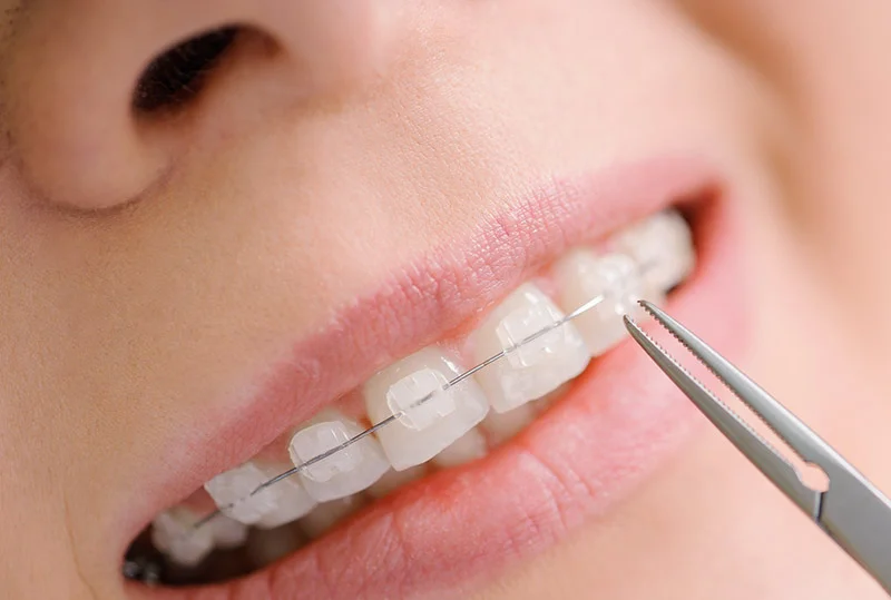 Services — The Pines Dental Surgery