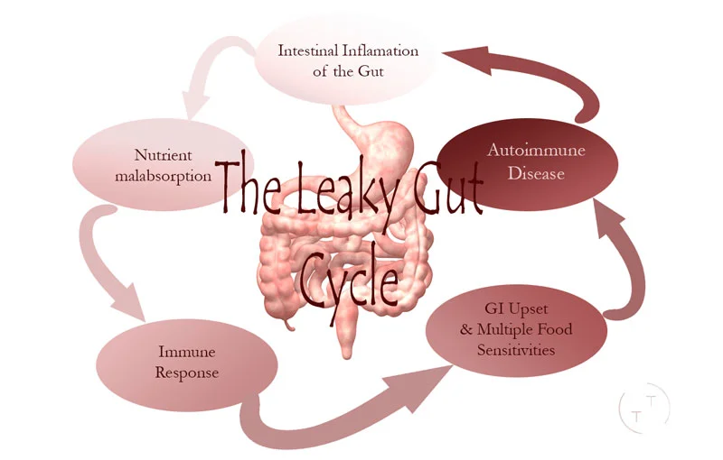 Click the image to learn more about the importance of a healthy gut