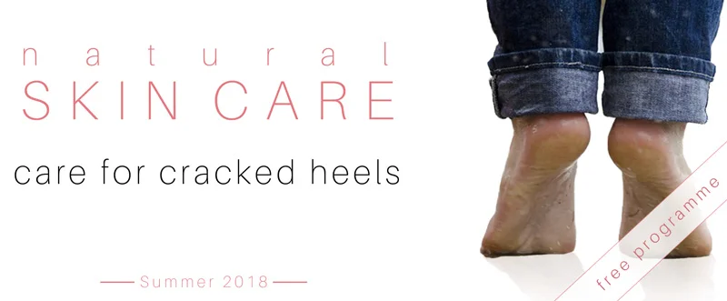 02-cracked-heels.jpg