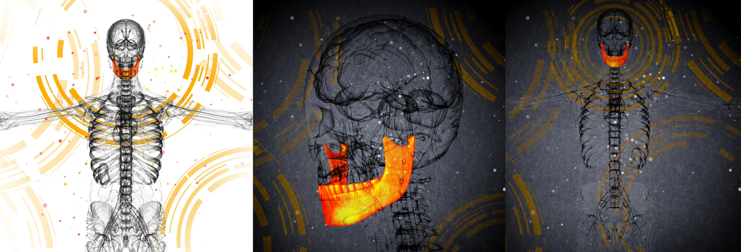 Biological Dentistry/Medicine & Ceramic Implants — Martha Cortés, DDS