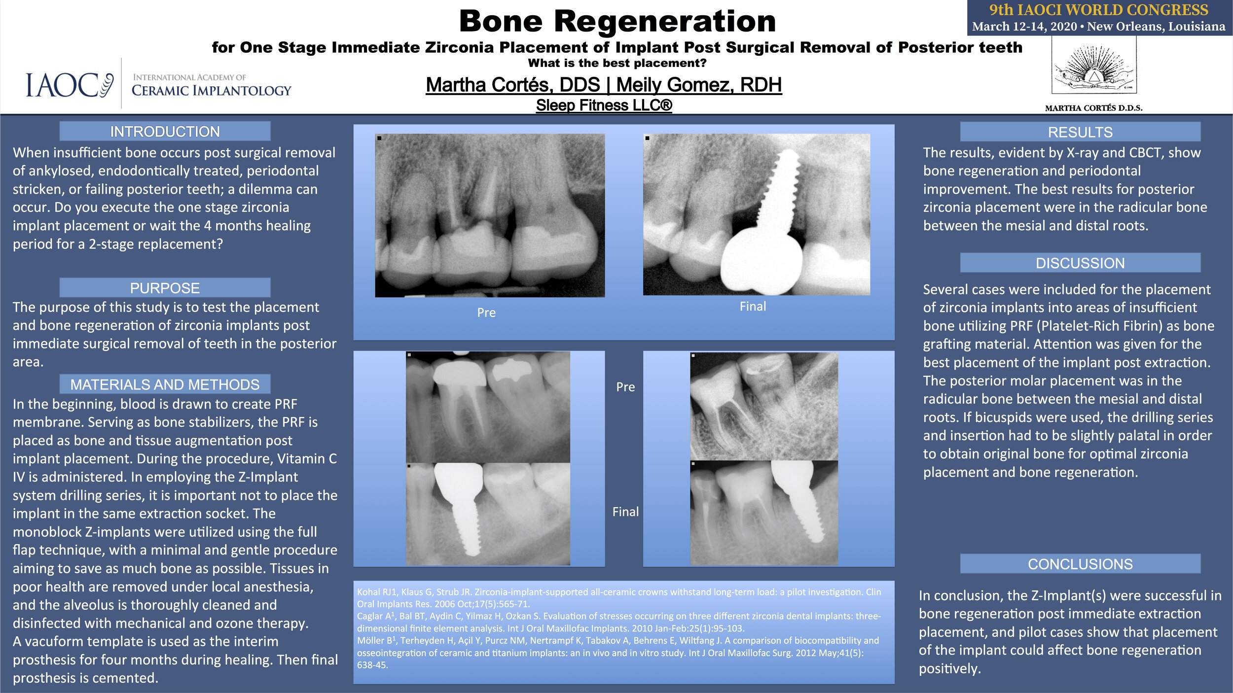  9th IAOCI World Congress Poster Presentation on Bone Regeneration for One Stage Immediate Zirconia Placement of Implant Post Surgical Removal of Posterior Teeth. 