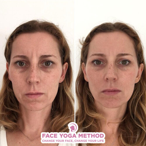 Before & After — Houston Face Yoga