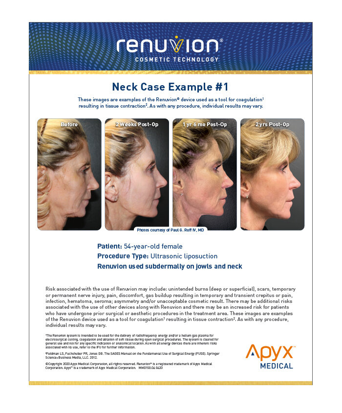 Renuvion B&amp;A