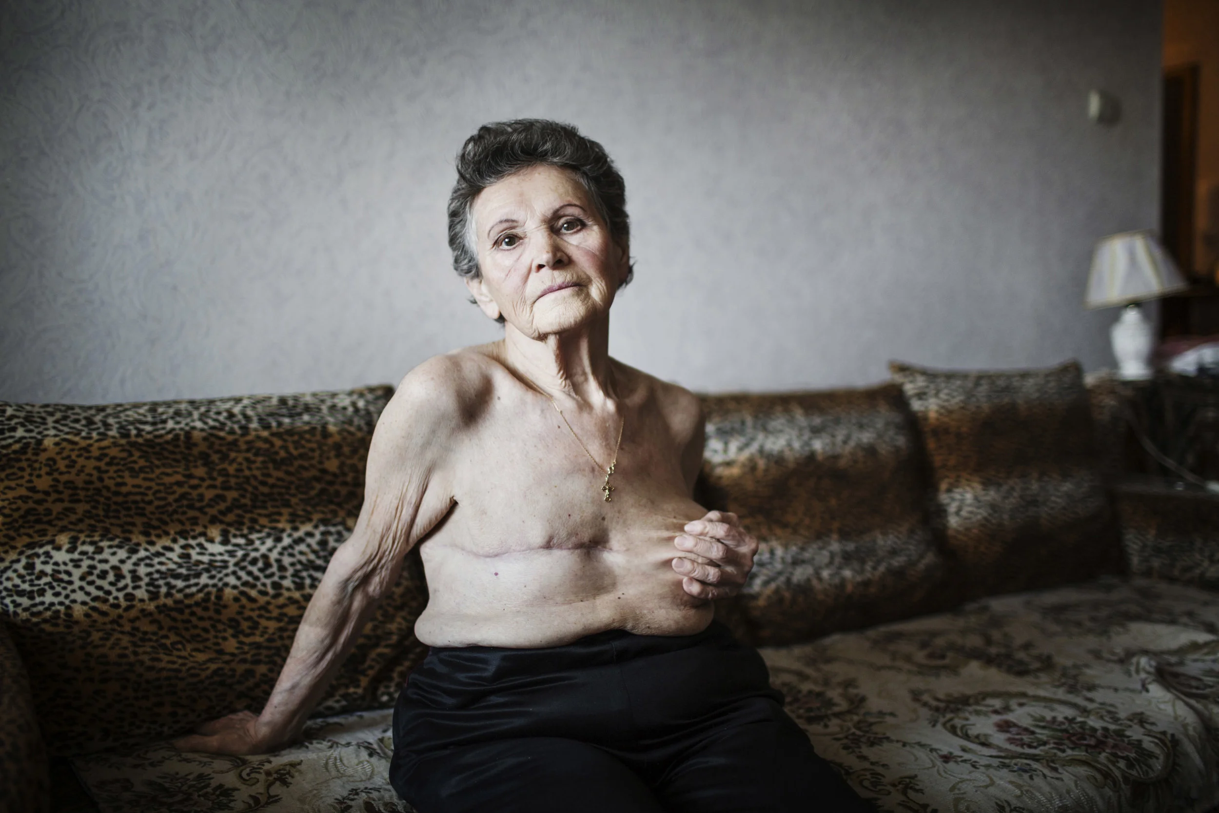  Before the meltdown three decades ago, Galina Guslina lived in Chernobyl, working at the nuclear power plant. Last year she discovered a tumor in one of her breasts. And she is not alone. Many of her colleagues have died of cancer. “One friend passe