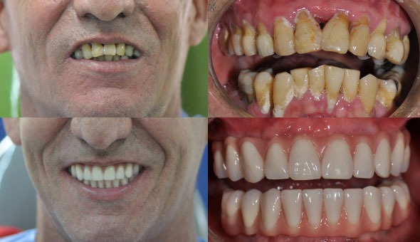 Tips for finding a cosmetic dentist