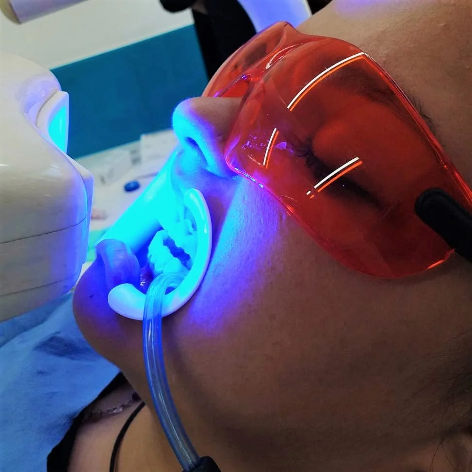 Teeth Whitening in Colombia (Cartagena, Medellin, Cali, Bogota