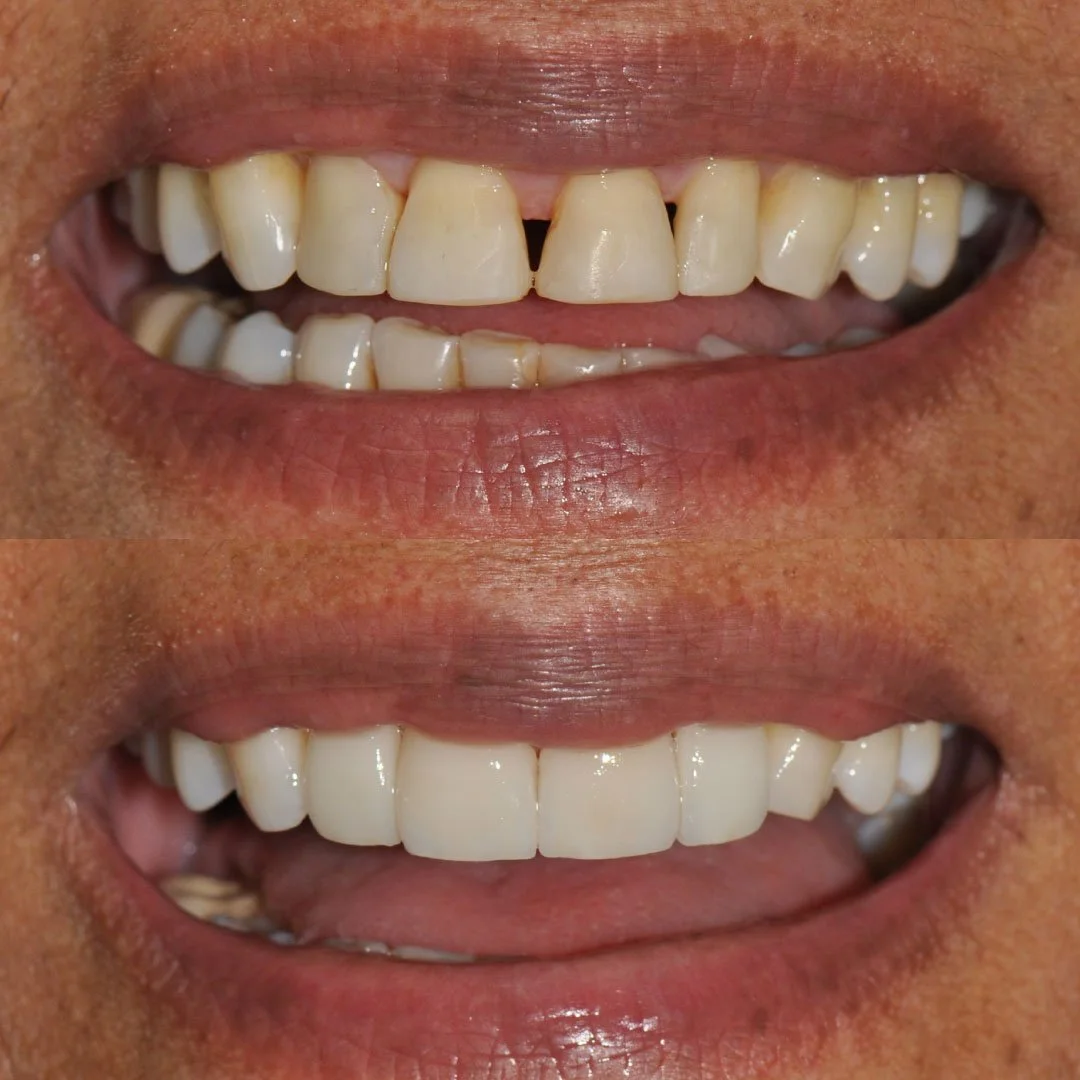 Dr. Johana Ossa Photos — Dental Tourism Colombia