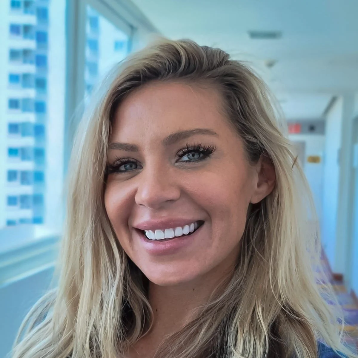 How Colombia Creates the Best Veneers in the World Dental Tourism