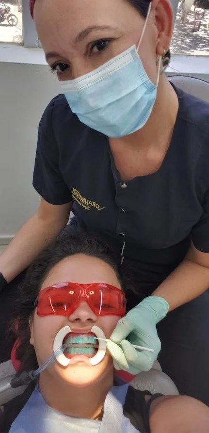 Professional teeth whitening treatment at Dental Tourism Colombia in Medellín
