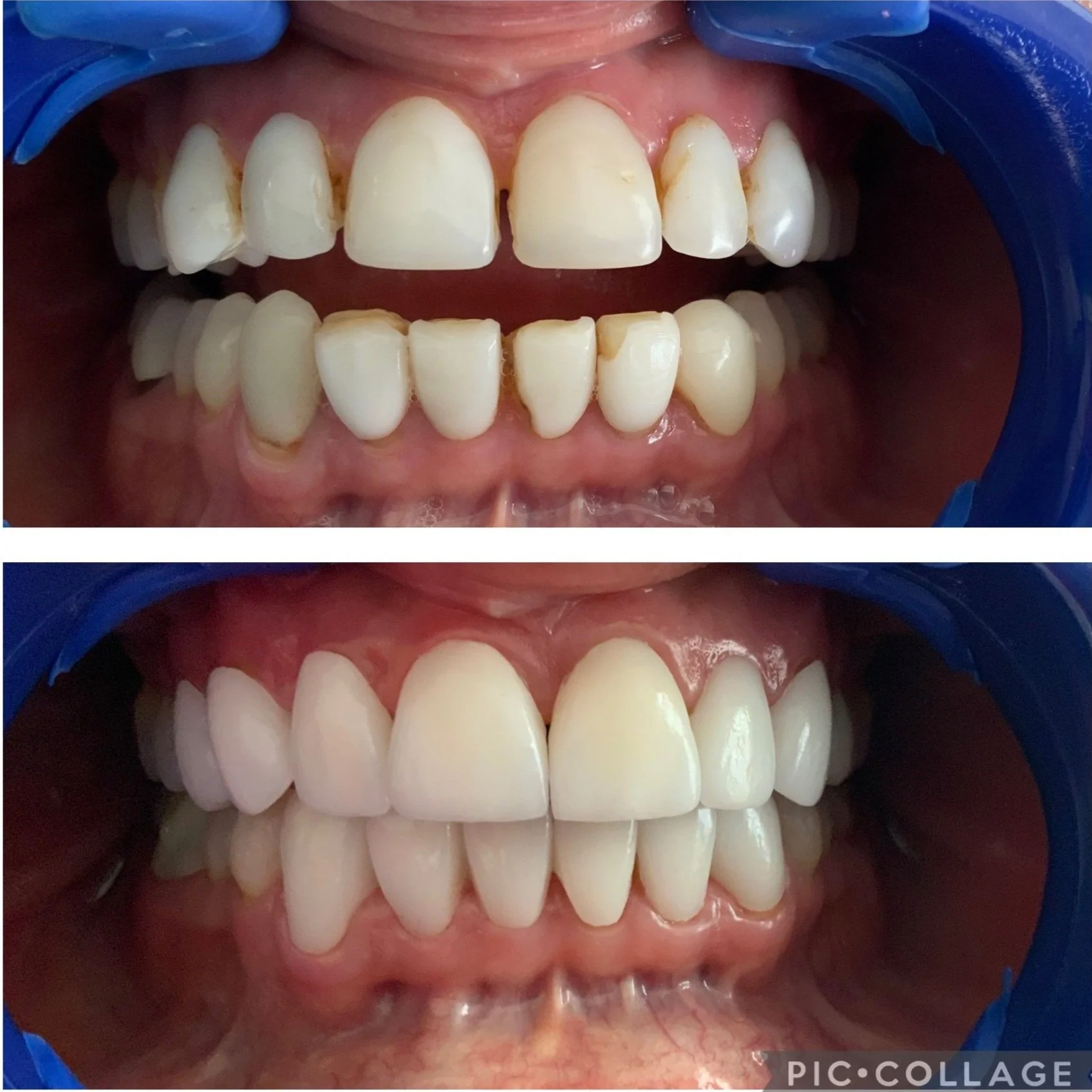 Bogota Dentist, Dr. Liliana Porras — Dental Tourism Colombia