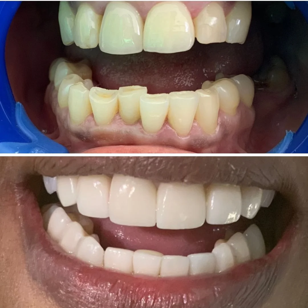 Bogota Dentist, Dr. Liliana Porras — Dental Tourism Colombia