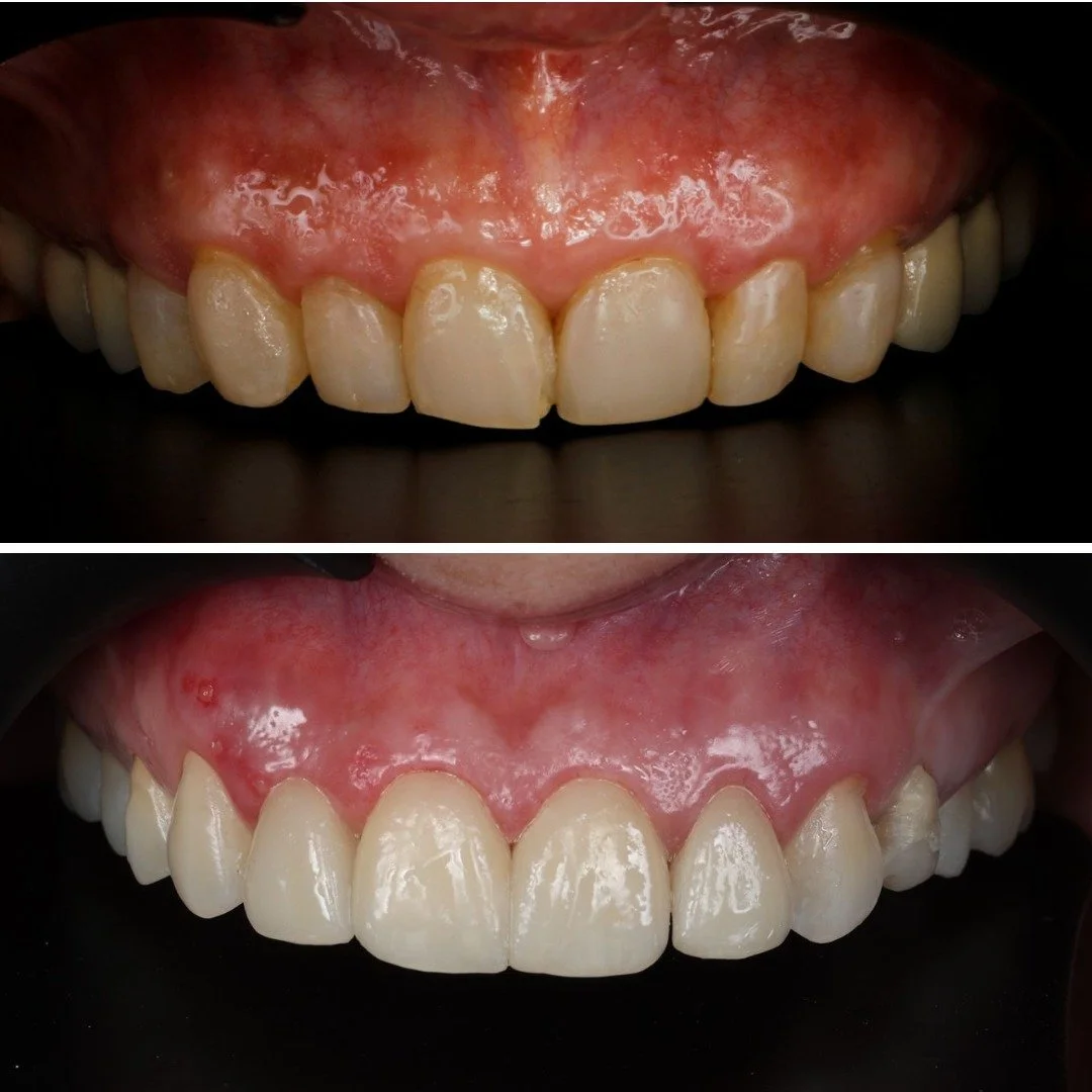 Dr. Juan Fernando Uribe (Cali Dentist) — Dental Tourism Colombia