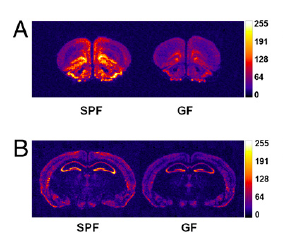 Proteins involved in anxiety and learning are expressed differently in control (SPF-left) and bug-less (GF-right) mice. For those interested, A is NGF-1A, B is BDNF