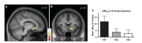 Yellow spots indicate areas where dopamine levels changes