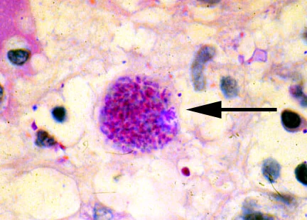 T. Gondii cyst chilling in the brain. Can it really be harmless? Source: http://wiki.ggc.edu/