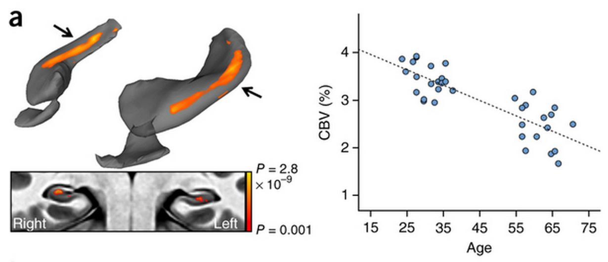 Left: Both left and right DG activate while doing the curve-discrimination task. Right: DG blood volume (and hence, inferred activity) decline steadily with age.