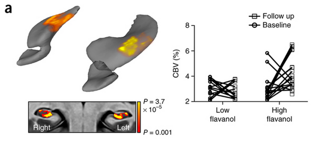 Left: Comparing high- to low-flavanol groups, the former shows activation in the body of the hippocampus. Right: Blood volume (CBV) changes for every volunteer.