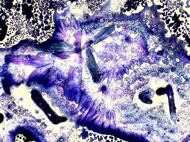 #findyourcenter
(+ stick to it)
&mdash;
Microscopic art &copy; @mmicroww
&mdash;
#mmicroww #hottip
#tendyourowngarden #changestartswithyou #abstract #microscopic #brainmap #abstractphotography #mystical #microscopy #macromicro #asabovesobelow #aswith