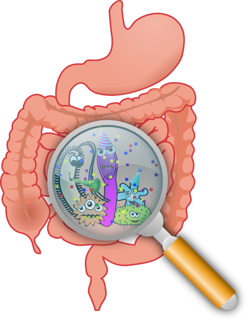 Gut microbiome and PCOS