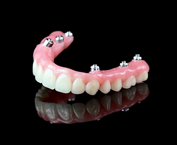HYBRID DENTURE