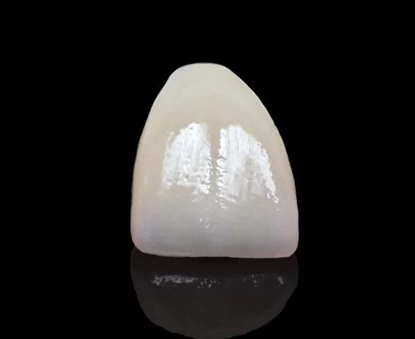 Fixed restorations comprised of, but not limited to, alloy, porcelain, resin, or zirconia are warranted for 5 years* from the date of manufacture. Empress and Resin carry a two-year warranty. New requests for feldspathic veneers will no longer be warranted.