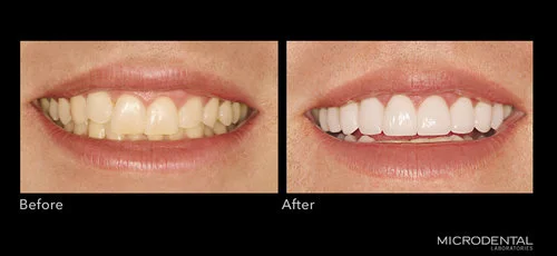 Dentistry by Dr. Kenneth Hamlett, Dallas, TX