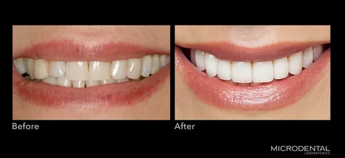 Dentistry by Dr. Alan Montrose, Beaverton, OR