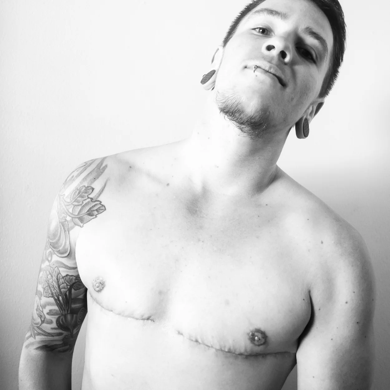 One Month Post Op - FTM Top Surgery - Video Update