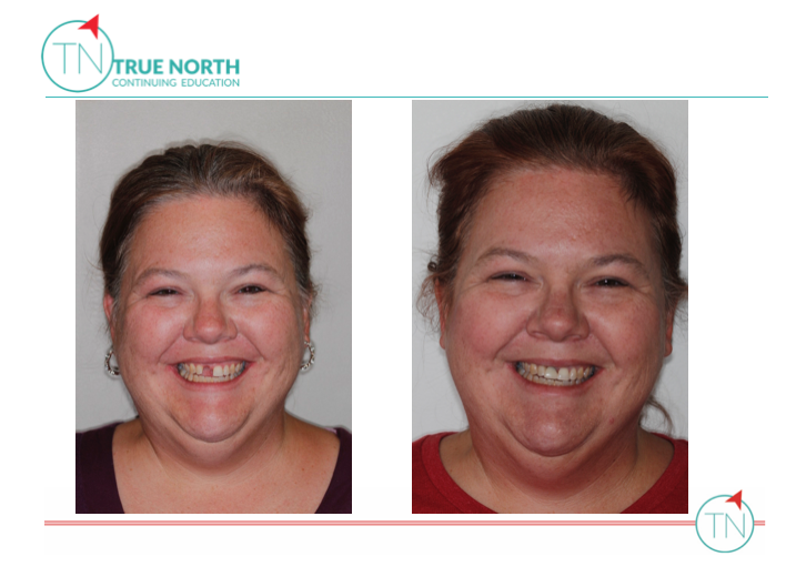 Screen Shot 2017-08-13 at 3.27.54 PM.png