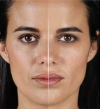 Before & After