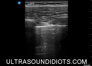 Ultrasound Idiots — Trauma / EFAST