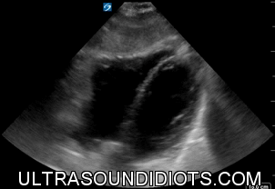 Pericardial Exam 2
