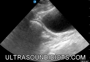 Pelvic Exam 7