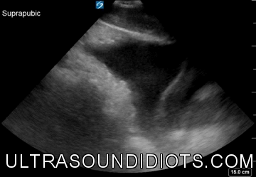Pelvic Exam 9