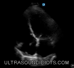 Ultrasound Idiots