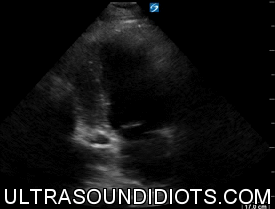 1iv8b5-1.gif